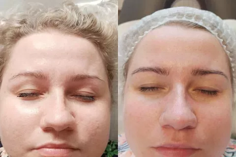 twarz przed i po 9